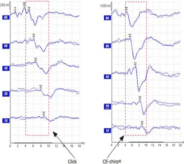 Şekil 2.5: CE-Chirp uyaran ile click uyaran karşılaştırılması (59) 
