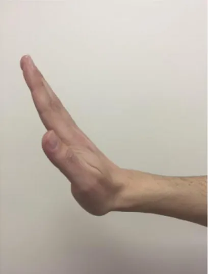 ġekil 2.4.3. II-V. parmakların abduksiyon hareketleri 