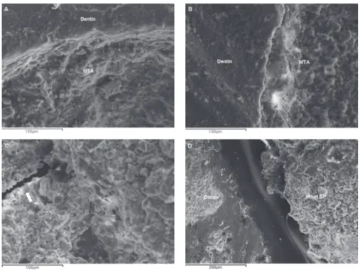Fig. 2  Representative  SEM  micrographs  of  Group  1  (EDTA/MTA)  (A)  and  Group  3  (laser  irradiation/MTA) (B) reveal good adaptation of MTA filling to root dentin.