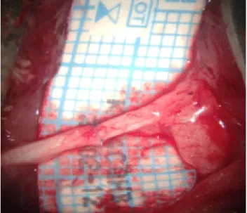 Figure 1. Image of sciatic nerve that was end to end anastomosed.