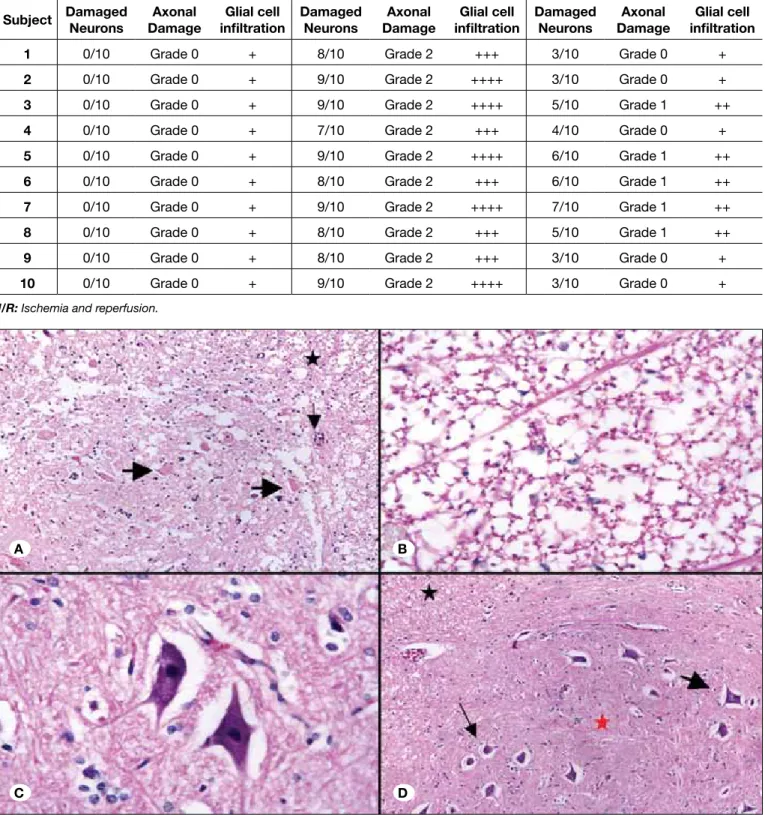 Table II:  Results of Histopathological Evaluation