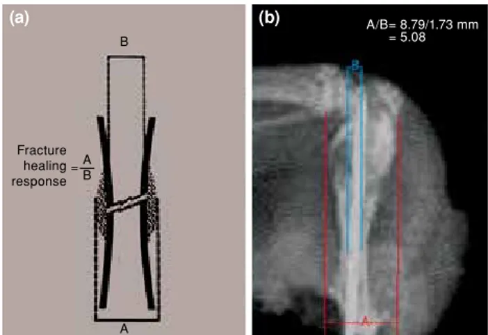 Figure 3. View of callus/diaphysis ratio measurement. [9] (a) View of callus/diaphysis ratio measurement