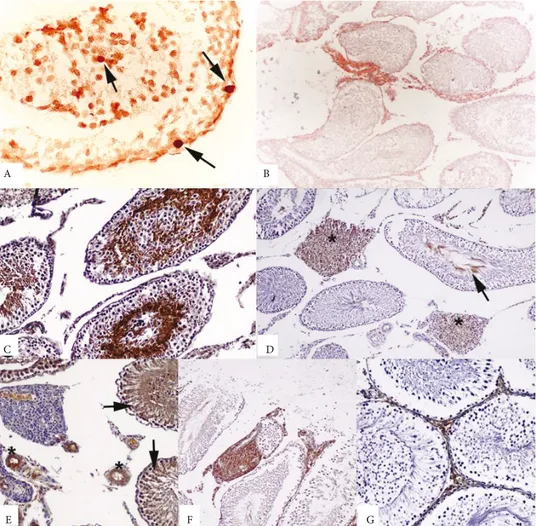 Figure 1.  A) TUNEL-positive cells in I/R-induced testicular injury (arrows). TUNEL assay, POD converter, DAB chromogen