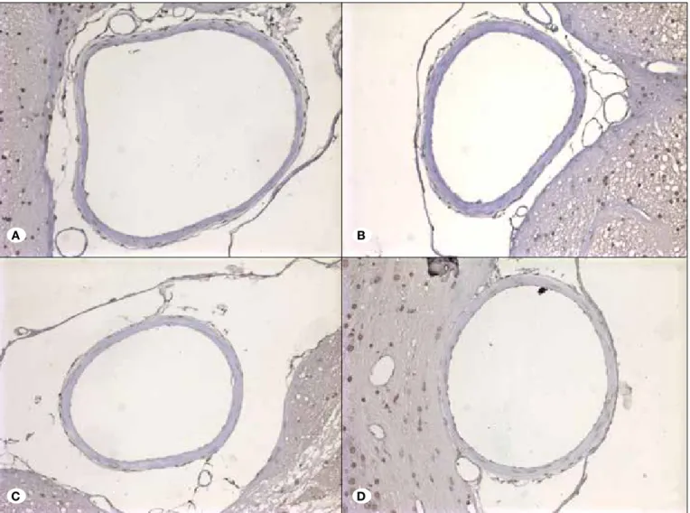 Figure 1: A) The lumens of the basilar arteries in the control group were covered by a simple lining of endothelial cells