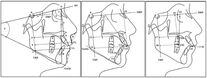 Figure 2.  Reference planes and cephalometric measurements used in the study. Reference planes: Horizontal reference plane (HRP), a horizontal plane angulated 