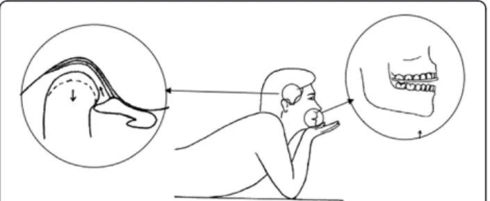 Figure 1 Exercise position with the pivot splint.