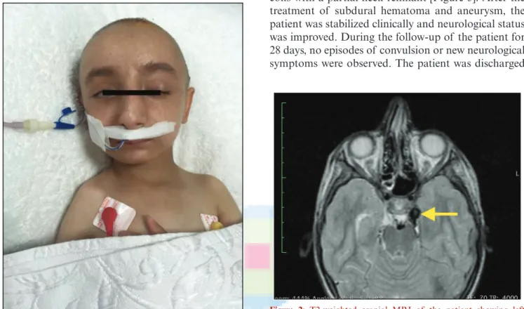 Figure 1: Characteristic appearance of the patient