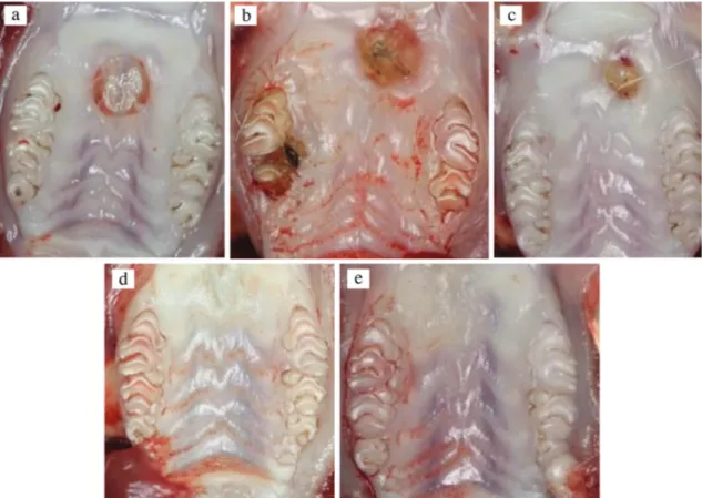 FIG. 2. a-e. Clinical photographs of the palatal wounds showing gradual healing taken at days 0 (a), 3 (b), 7 (c), 14 (d), and 21 (e) from the test group.
