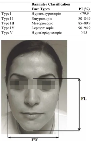 Fig. 1. The determination of face length (FL) and face width (FW). Bannister ClassificationFace  Types PI (%)Type IHypereuryprosopic≤79.9Type I IEuryprosopic 80–84.9Type I IIMesoprosopic85–89.9Type I VLeptoprosopic90–94.9Type VHyperleptoprosopic≥95