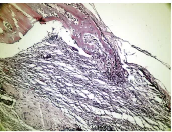 Figure 2. Seventh day empty defect with LPT in Group I. Note: New bone trabecules in active connective tissue, which consist of young mesenchymal stem cells (H&amp;E £ 200)