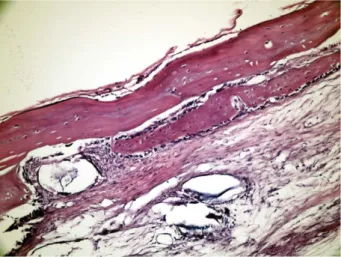 Figure 5. Fourteenth day grafted defect with LPT in Group I. Note: Bridge-like new bone formation covering the defect (H&amp;E £ 200)