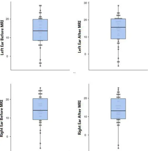 Fig. 1. DPOAE 4000 Hz values before and after MRI in right and left ears.