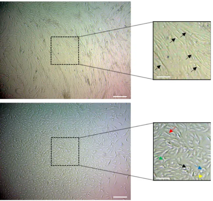 Figure 1. Morphology of ASCs isolated from lumbar subcutaneous and epidural fat tissues cultured in vitro