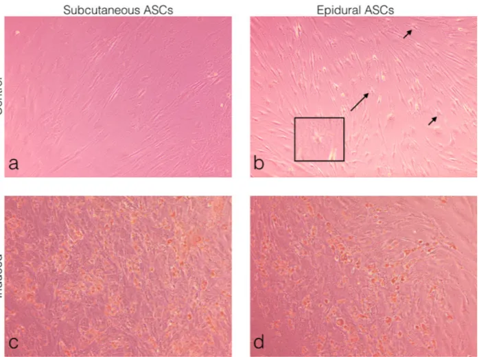 Figure 4. Morphological observations of the ASCs under light microscopy. (a) Subcutaneous ASCs cultured in normal growth medium 