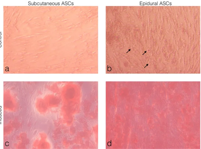 Figure 5. Morphological observations of the ASCs under light microscopy. (a) Subcutaneous ASCs cultured in normal growth medium 