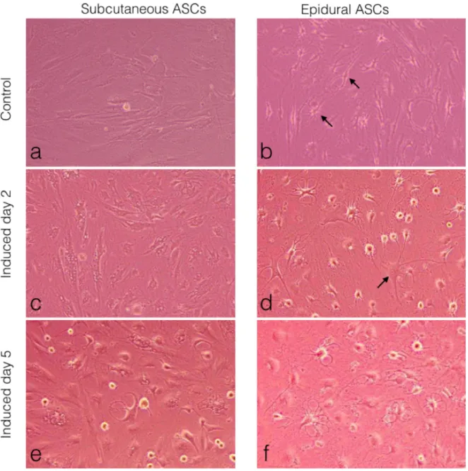 Figure 6. Morphological observations of the ASCs under light microscopy. (a) Subcutaneous ASCs cultured in normal growth medium 