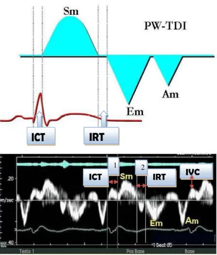 Şekil 3.1.  Doku Doppler görüntülemede kullanılan parametreler. ICT (1 numaralı ok), izovolemik 