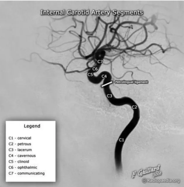 Şekil 2. İnternal Karotid Arterin segmenter anatomisi-DSA görüntüsü 