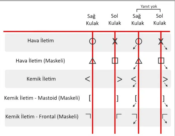 Şekil 9. Odyogram Sembolleri 