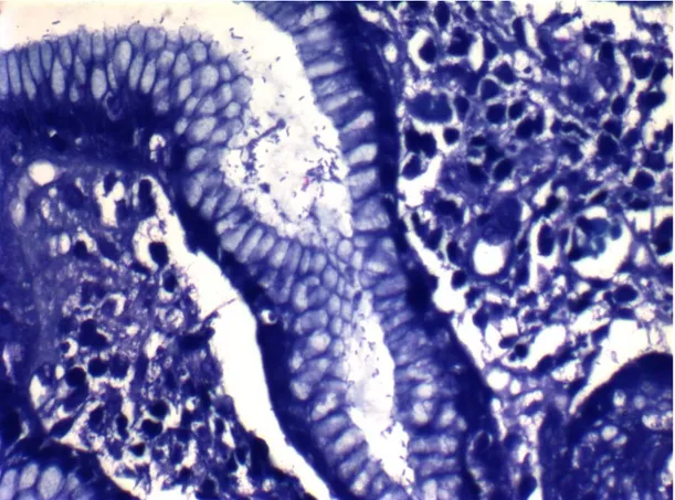 Şekil 2.2.: H.pylori mikroorganizmasının Giemsa boyasıyla gastrik mukozal yüzeyde  görünümü  (Bu çalışmada yer alan olgulardan birine aittir) 