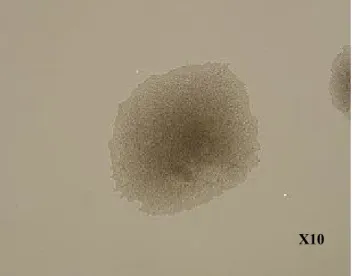 Şekil 3.2. C. glabrata suşunun, mısır-unlu Tween 80 kültür plaklarında mikroskobik görünümü     