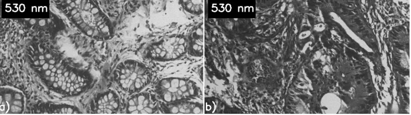 Şekil 4.2 530 nm’ de sağlıklı(a) ve kanserli(b) kolon dokusundan alınan görüntüler 