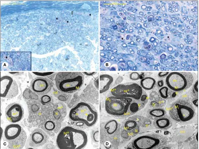Figure 3: A, B) Trauma Group Semi-Thin Section; M: Large diameter nerve fiber with myelin, M g : Degenerative large diameter nerve 