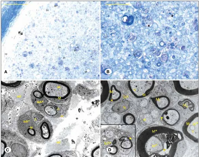 Figure 5: A,B) Trauma+vitB12 group semi-thin section; M: Large diameter nerve fiber with myelin M*: Degenerative large diameter  myelinated nerve fiber, m: Small diameter nerve fiber with myelin, m*: Degenerative small diameter nerve fiber with myelin, Bv: