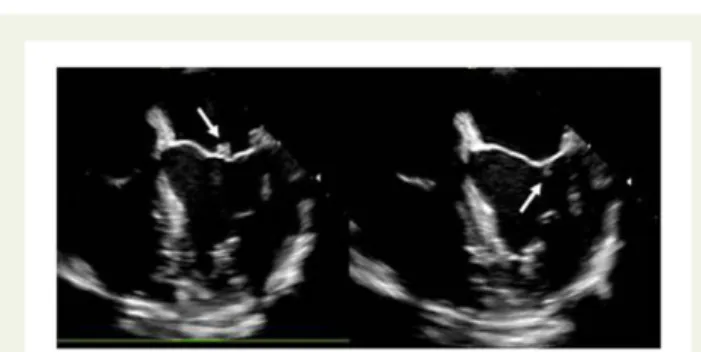 graphic screening in the initial workup might help to detect cardiac