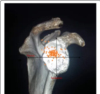 Fig. 2 The distribution of glenoid inclination and version angle for the torn-cuff group
