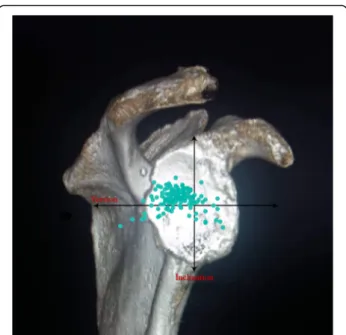 Fig. 3 The distribution of glenoid inclination and version angle for the intact-cuff group