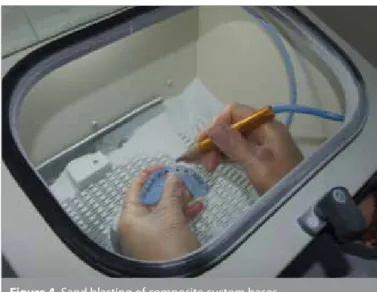 Figure 4. Sand blasting of composite custom bases