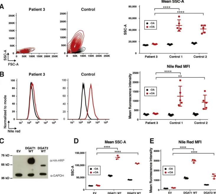 Figure 4. Loss of DGAT1 results in decreased lipid droplet formation in ﬁbroblasts. (A) Left: Representative contour plots for forward (FSC-A) and SSC-A of patient 3 and 2 control ﬁbroblasts with and without OA addition