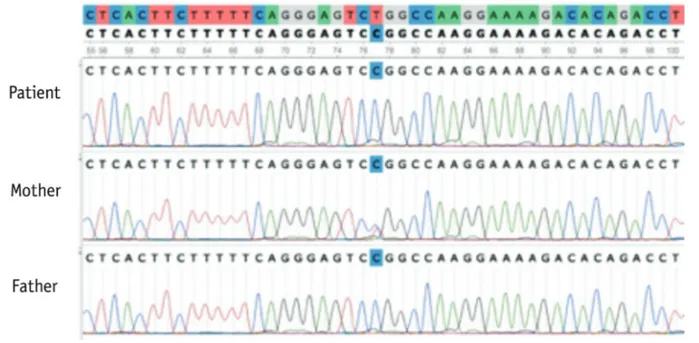 Figure 1. Sanger sequencing confirmation: (a) the mother (b), the father, and (c) the patient show heterozygous, hemizygous, and 