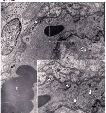 Figure 1: Electron micrograph of the peripheral compartment of a floating villus in term  placenta