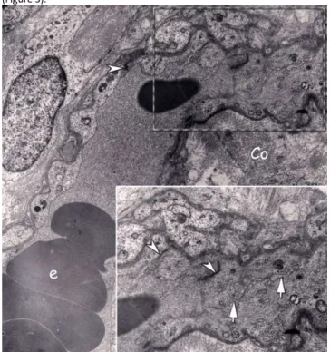 Figure 1: Electron micrograph of the peripheral compartment of a floating villus in term  placenta