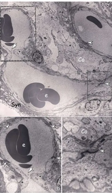 Figure 5:  a) Another capillary adjacent to vasculosyncytial membrane. Intussusception  area marked by dashed line
