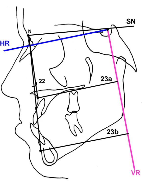Şekil 3.7  Araştırmada kullanılan maksillo-mandibular iskeletsel ölçümler. 