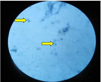 Şekil 3.3. Metilen mavisiyle boyanan hücrelerin ıĢık mikroskobu altında sayılması (Kök 