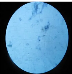 Şekil 3.5. Metilen mavisiyle boyanan hücrelerin ışık mikroskobu altında sayılması. 