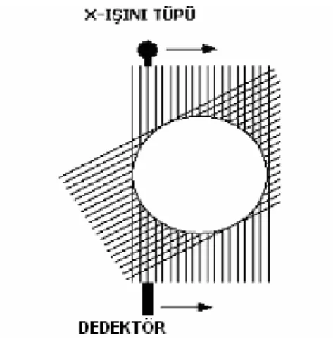 Şekil 2.1.   Birinci jenerasyon BT cihazında pencil-beam x-ışını ve karşısında 