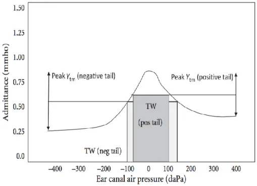 Şekil 2: Timpanometride değerlendirilen parametreler (2). 