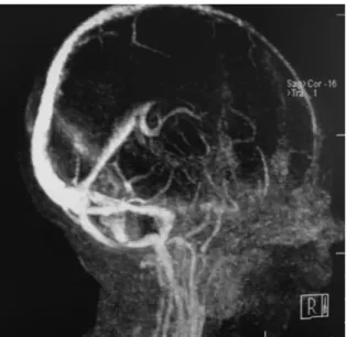 Fig. 1. The magnetic resonance imaging (MRI) venography 