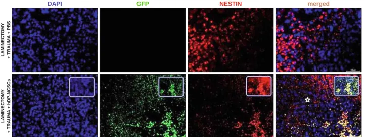 Fig. 4. Detection of Nestin positive cells in the SCI lesion site (star). The expression of Nestin - a protein marker for neural stem cells – was induced  in the tissue by the signals derived p.i