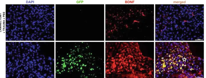 Fig. 6. Detection of BDNF in the SCI lesion site (star). The expression of this NF was induced in the tissue by the signals derived post injury