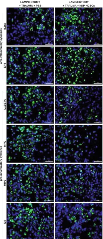 Fig. 8. The IF staining of paraffi n-embedded spinal cord tissue sec- sec-tions for IL1ra, EP3, IL1β, MPO, MIP2 and IL6 after transplantation  in Group 3 and 4