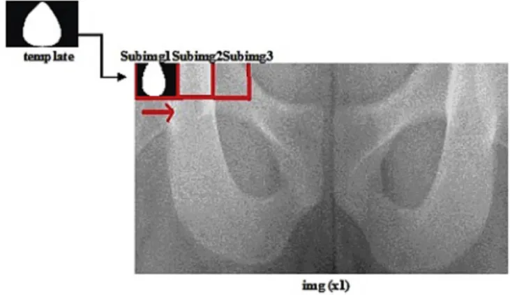 Fig. 1. Identifying the starting reference point (center of mass of the obturator fora- fora-men)