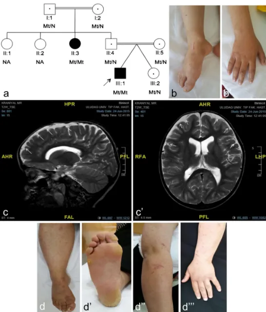 Fig. 1 The PLACK family and clinical features. a Pedigree of PLACK family. Parents are first cousins