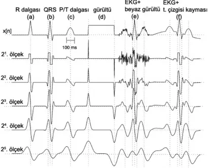 Şekil 2.15 Simülasyon yolu ile elde edilmiş bir EKG sinyali ve dalgacık dönüşümü 