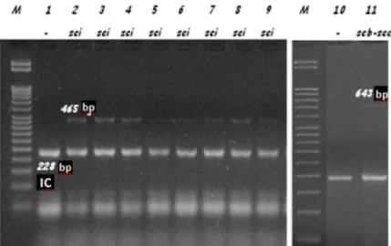 Figure 1. Enterotoxin genes identified by PCR. M represents 50-bp molecular weight marker (Fermentas, Lithuania), IC represents  internal control (228-bp product of S